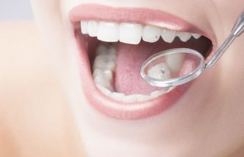 Patient at a dental exam