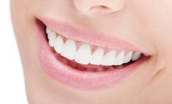 Are Dental Veneers Covered by FSA?