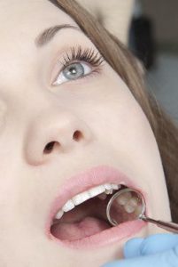 Female patient having her teeth examined