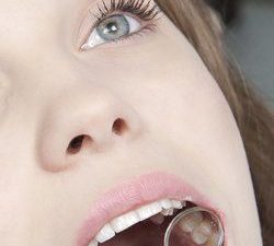 Female patient having her teeth examined