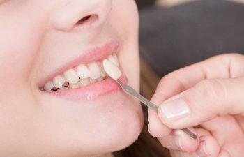 A porcelain veneer being placed on a tooth